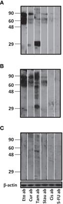 A pregnancy hormone-cell death link promotes enhanced lupus-specific immunological effects